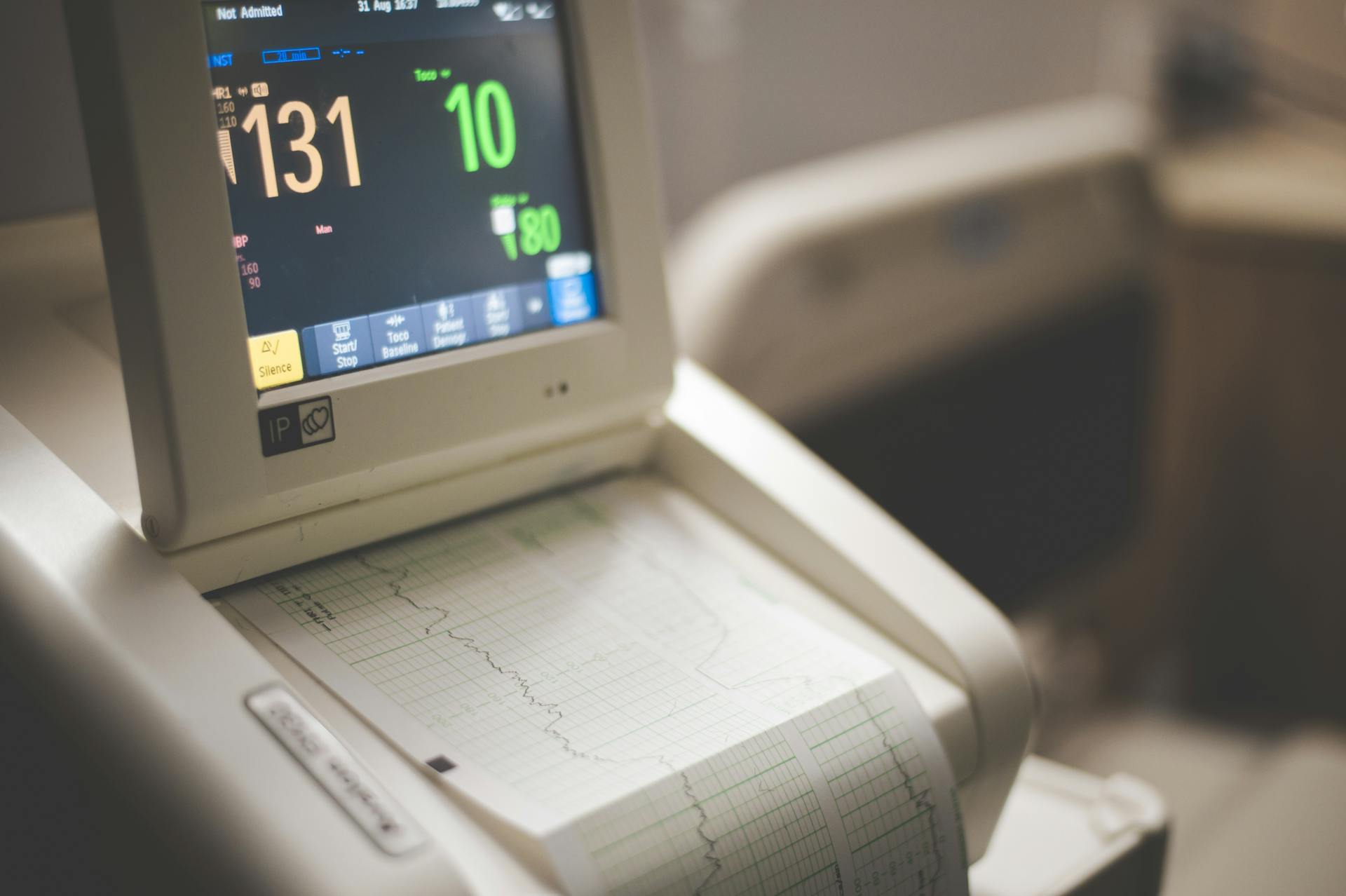 Fetal monitor (cardiotocograph) with digital display and paper tracing in a clinical setting